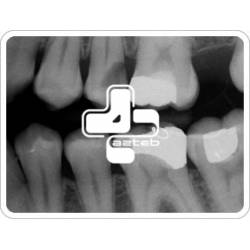رادیولوژی دندان